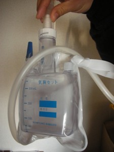 kikyoubagweb1 気胸バッグ。チューブの先には結局なにがついているのかわからなかったが、針的なものが刺さっているらしかった。これをポシェット(死語?)のようにぶらさげて24時間1週間生活。これじゃあ電車にも乗れませんね。うっとおしかったです。